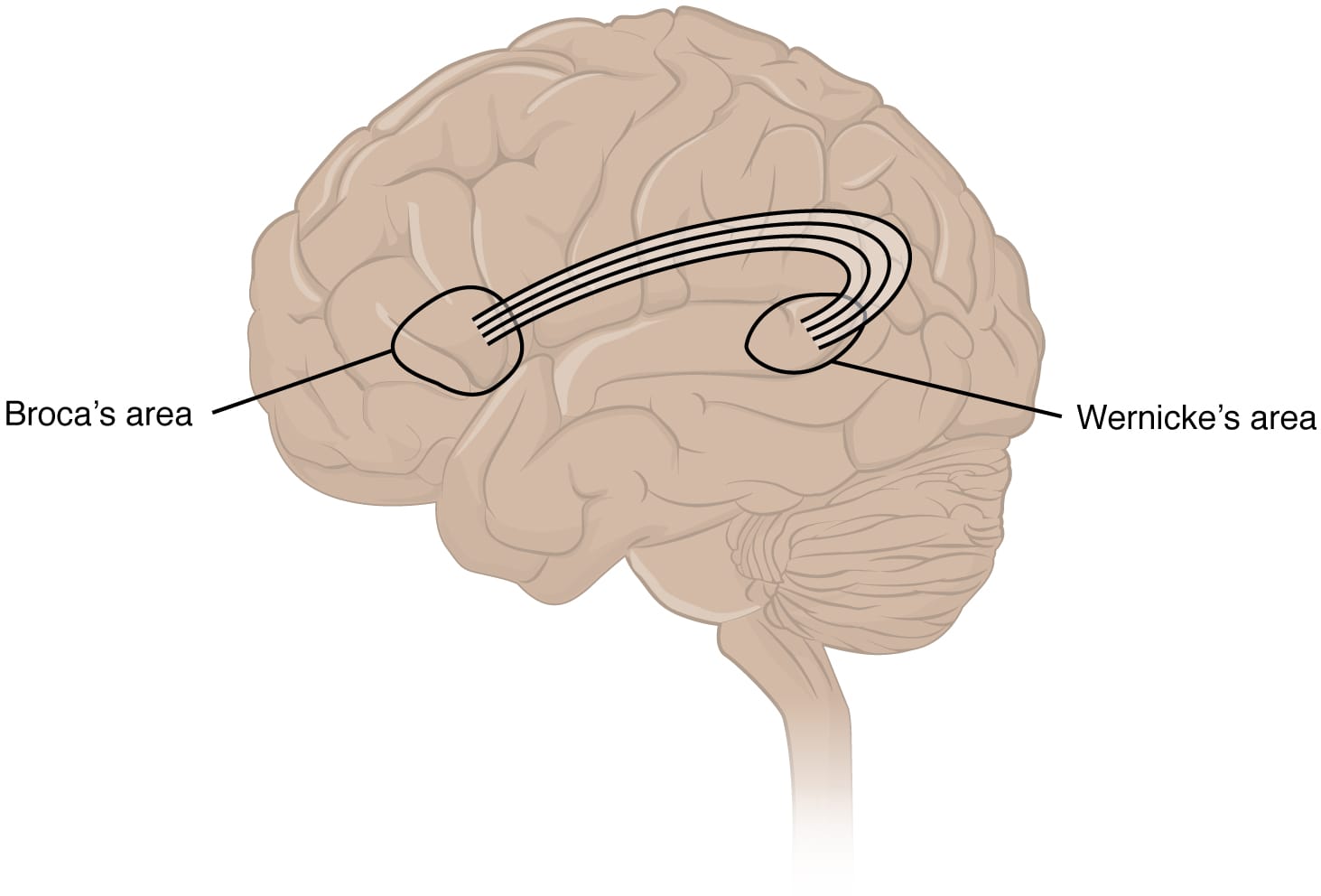 Cerveau vu de profil avec deux zones encadrées, aires de Broca et de Wernicke, reliées par un faisceau de fibres.