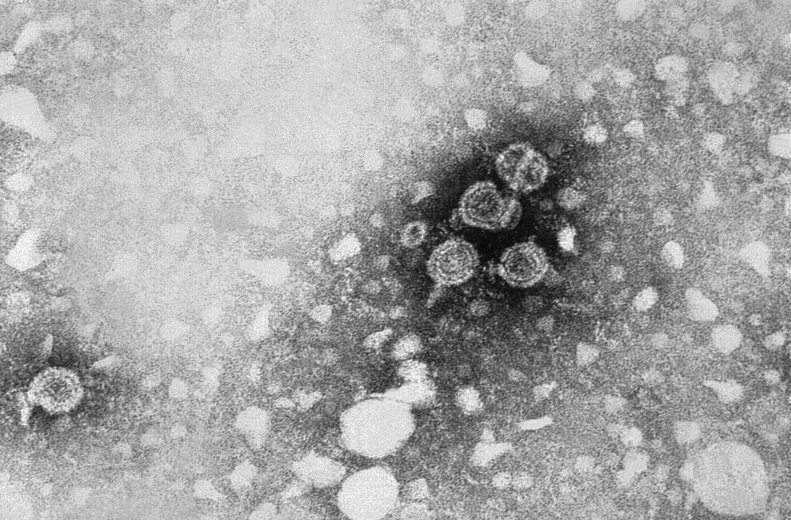 Particules du virus de l'hépatite B en microscopie électronique, en noir et blanc, sur fond gris clair.