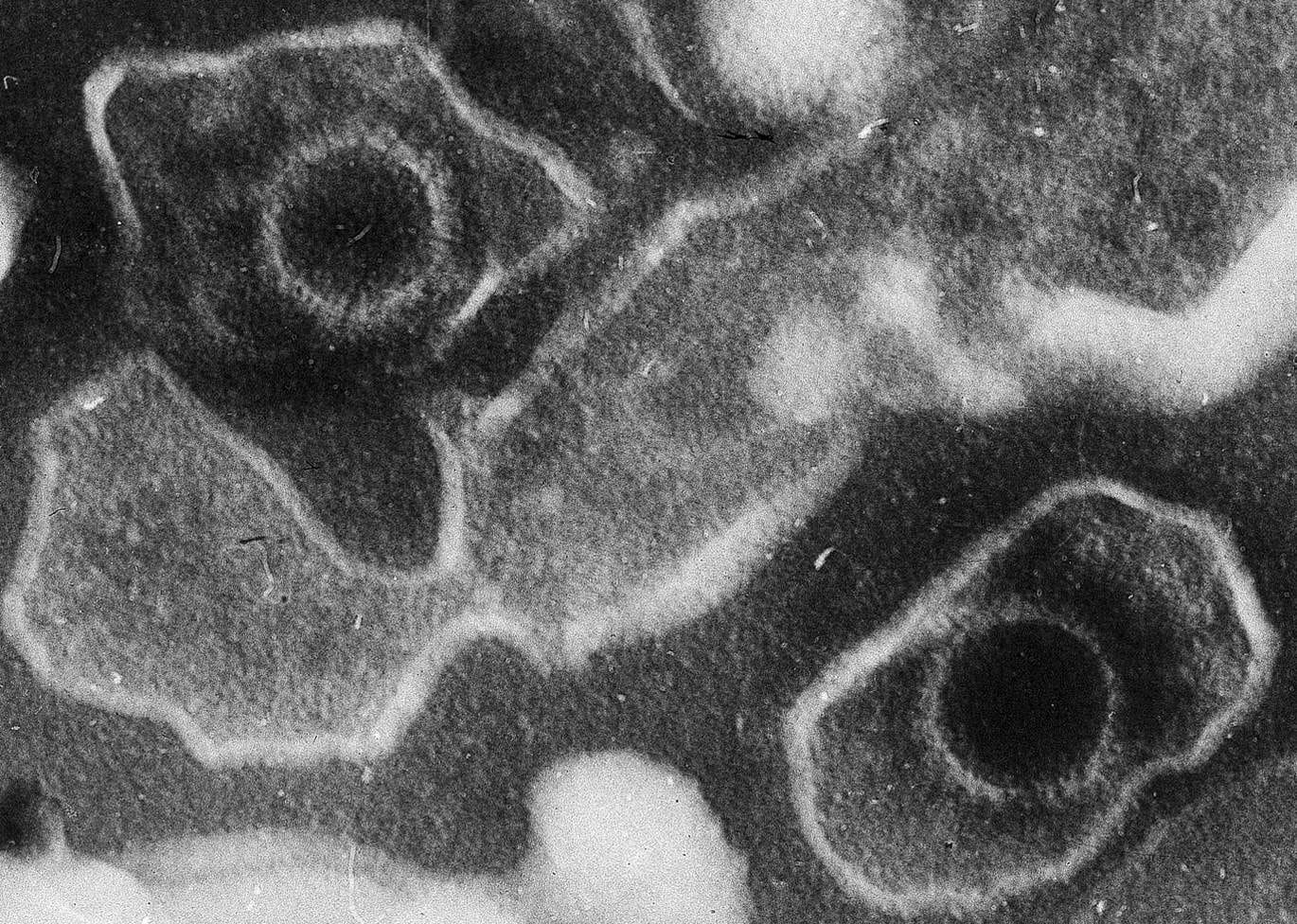 Deux virions du virus d'Epstein-Barr en microscopie électronique, en noir et blanc, avec capsides rondes et enveloppe.