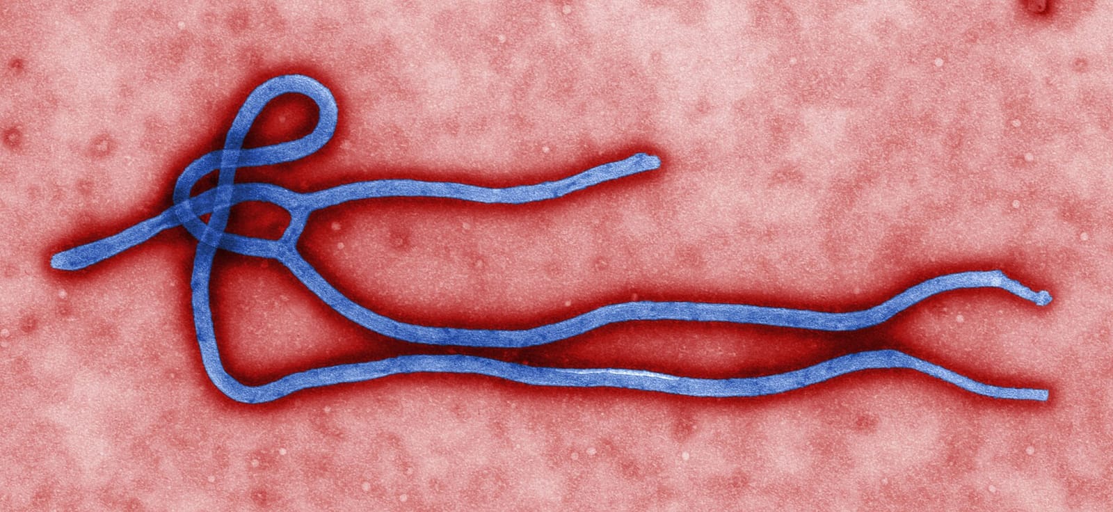 Particule filamenteuse du virus Ebola en microscopie électronique, en bleu sur fond rose.